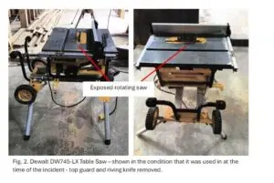 Thumbs Up For Docs Who Saved Teen’s Digit
