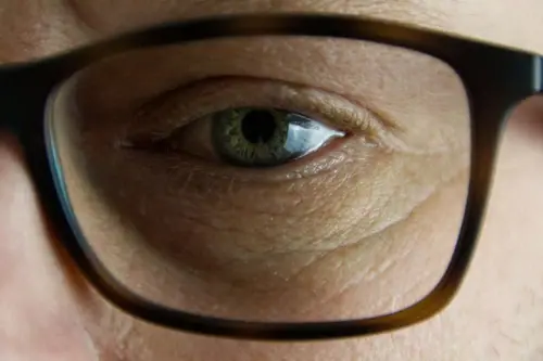 Stress Can Cause Problems For Your Eyes